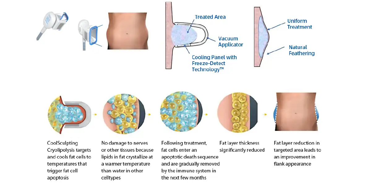 07 Working Principle of Cryolipolysis Machine