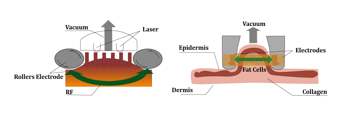 03-Vacuum-rf-roller-machine