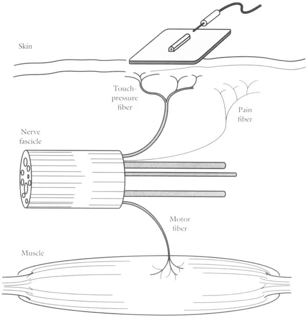 Electric Muscle Stimulation